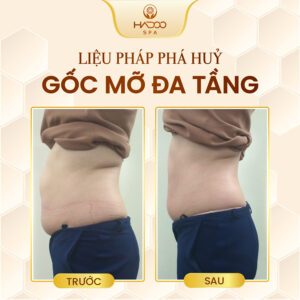 feedback-giam-beo-website-210822-6