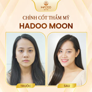 feedback-nan-chinh-website-210822-2