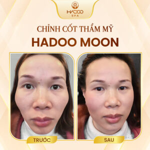 feedback-nan-chinh-website-210822-6