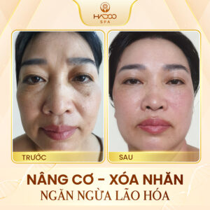 feedback-nang-co-website-210822-1