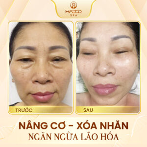 feedback-nang-co-website-210822-4